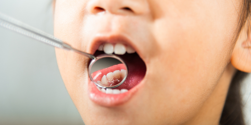 The Ultimate Guide to Oral Hygiene for Healthy, Natural Teeth